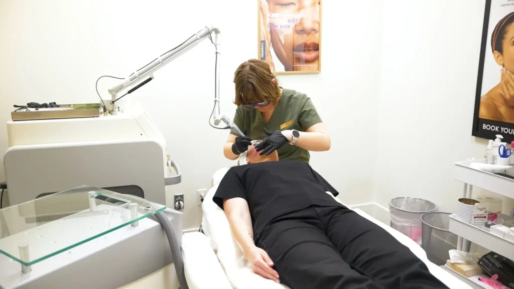Venus Bliss non-surgical fat reduction on abdomen in Kelowna at Healthpoint Cosmetic.