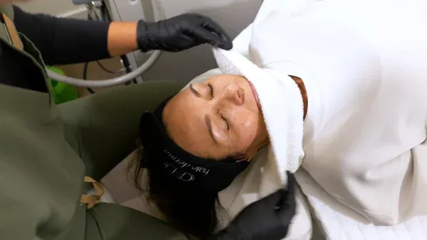 PicoWay Tattoo Removal Gallery 8