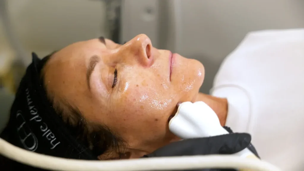 AlumierMD chemical peel for brighter skin in Kelowna at Healthpoint Cosmetic.
