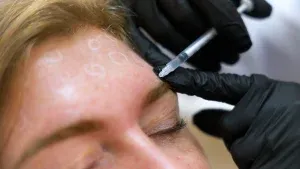 PicoWay Tattoo Removal Gallery 7