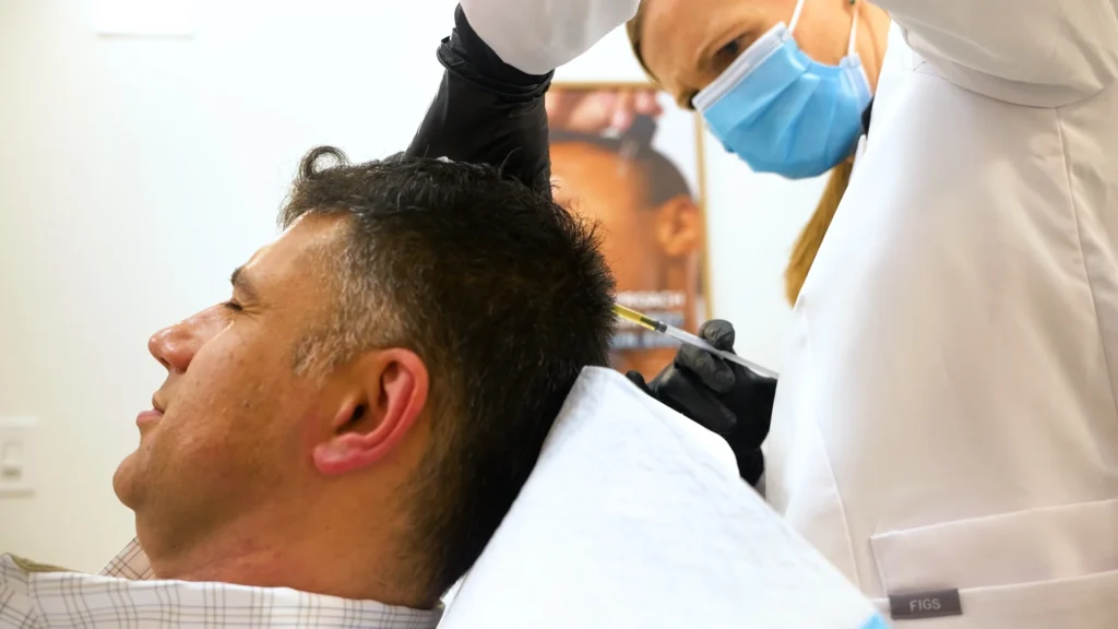 Exosome therapy applied after microneedling in Kelowna at Healthpoint Cosmetic.